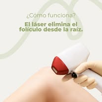 Cómo funciona la depilación láser